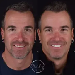 Dental result 2