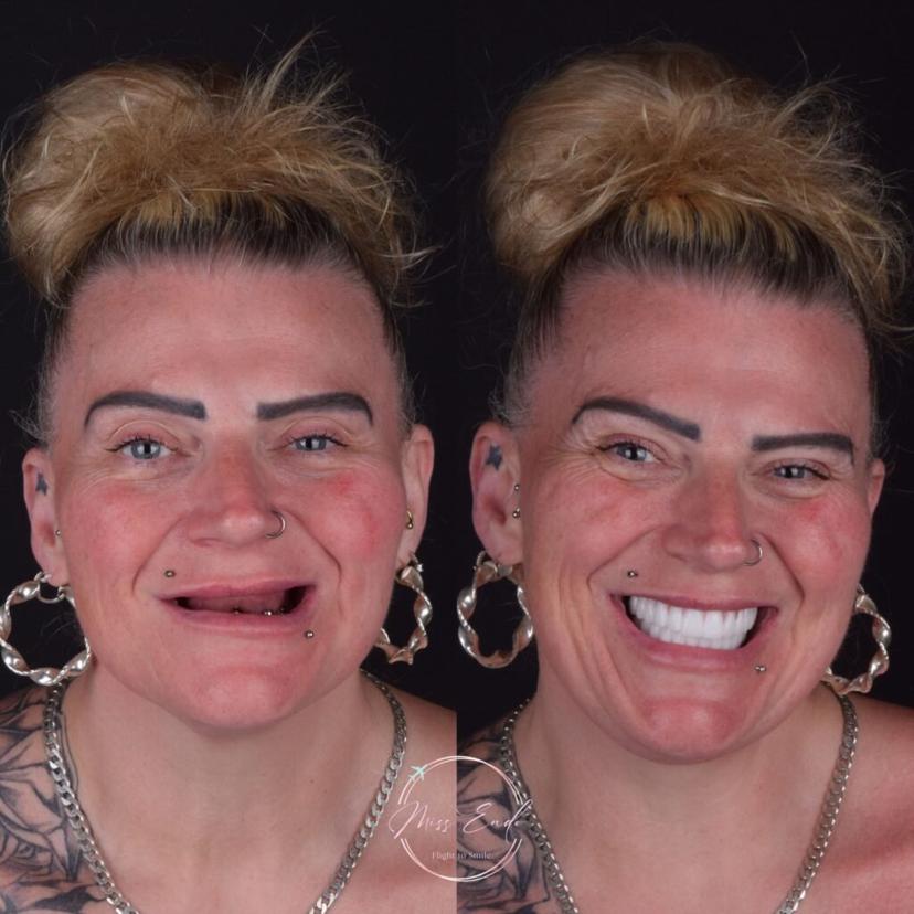 Dental smile makeover 3